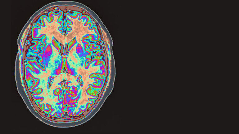 Μελέτη διερεύνησε τις επιπτώσεις της μητρικής φλεγμονής στον εγκέφαλο του εμβρύου